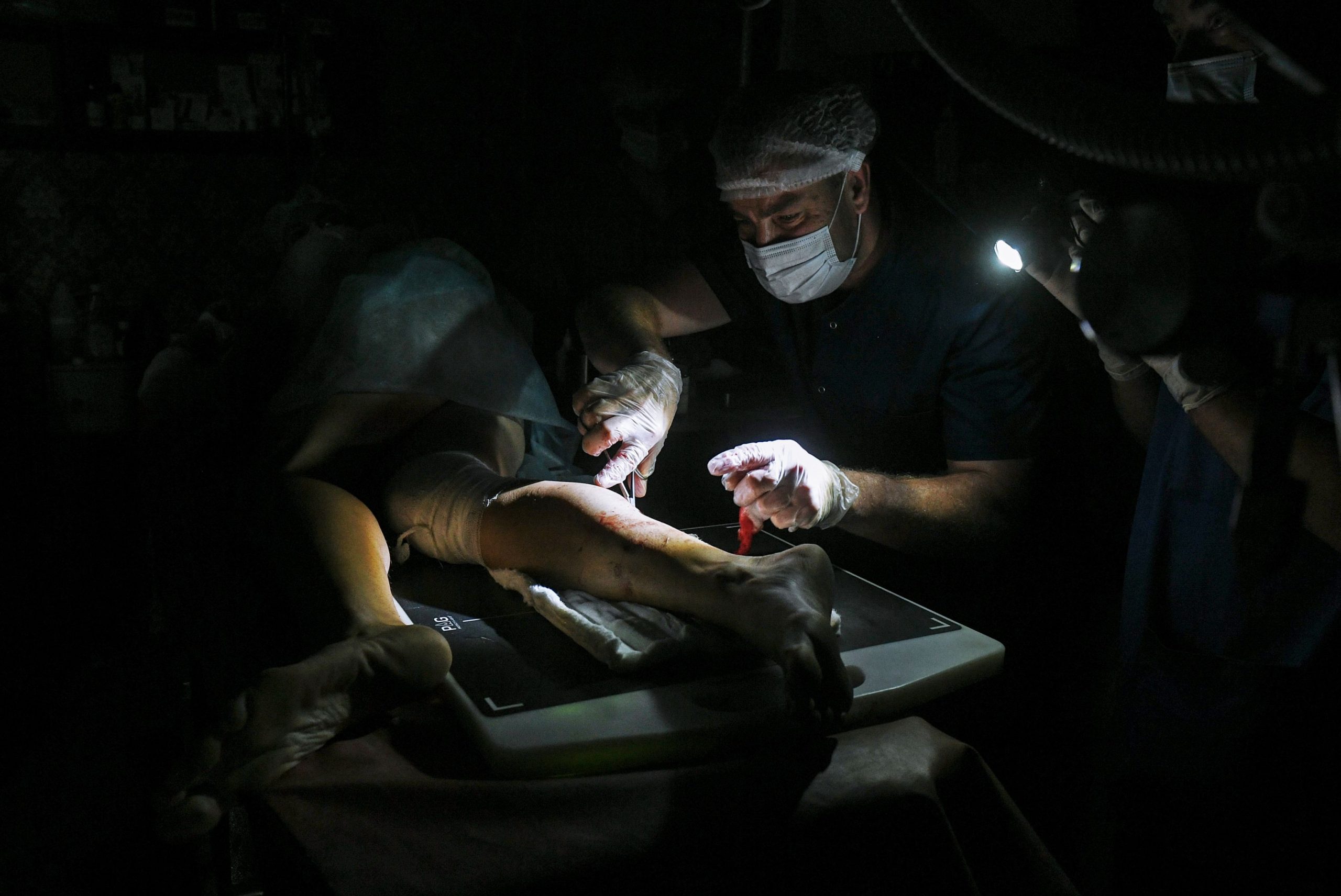 VIDEO. Operații la lumina lanternei. Medicii ucraineni salvează vieți chiar și în timp ce atacurile rusești lasă spitalele fără energie electrică