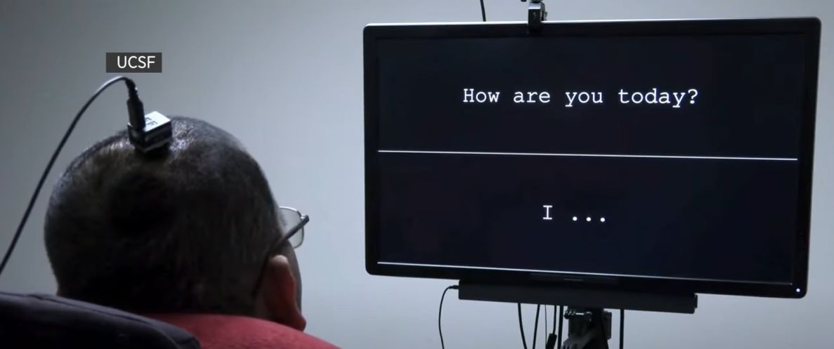 Implantul cerebral de „citire a gândurilor” îi permite unui bărbat din California, în vârstă de 36 de ani, să „vorbească” din nou, după ce la 20 de ani a fost paralizat de la gât în jos