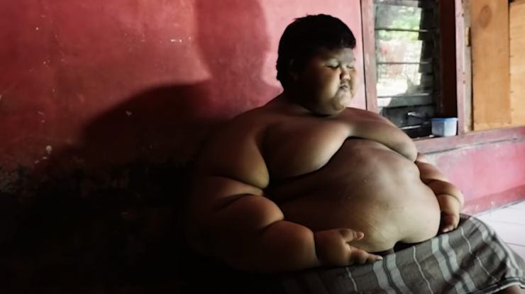 Cel mai gras băiat din lume suferă o transformare incredibilă și este acum de nerecunoscut