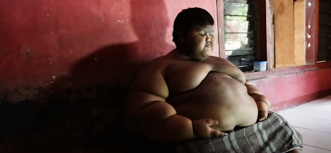 Cel mai gras băiat din lume suferă o transformare incredibilă și este acum de nerecunoscut