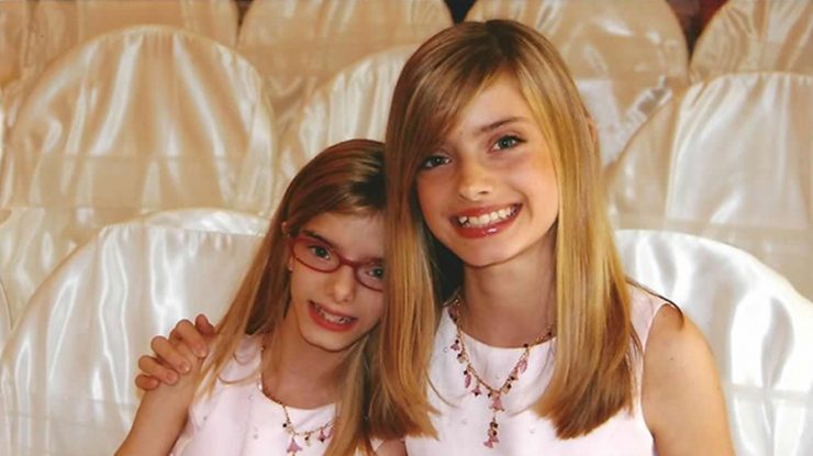 Surori gemene născute cu o afecțiune atât de rară încât au câștigat recordul Guinness World Record