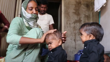 Trei frați cu o afecțiune misterioasă nu vor crește niciodată mai înalți decât copiii mici