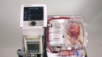 Cum a salvat o dronă viața unui pacient care aștepta un transplant de plămâni