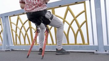 VIDEO. Piciorul bionic „Utah” îți redă mersul natural