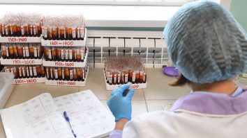 Cerecetătorii au dezvoltat un test de sânge accesibil pentru diagnosticarea bolii Alzheimer