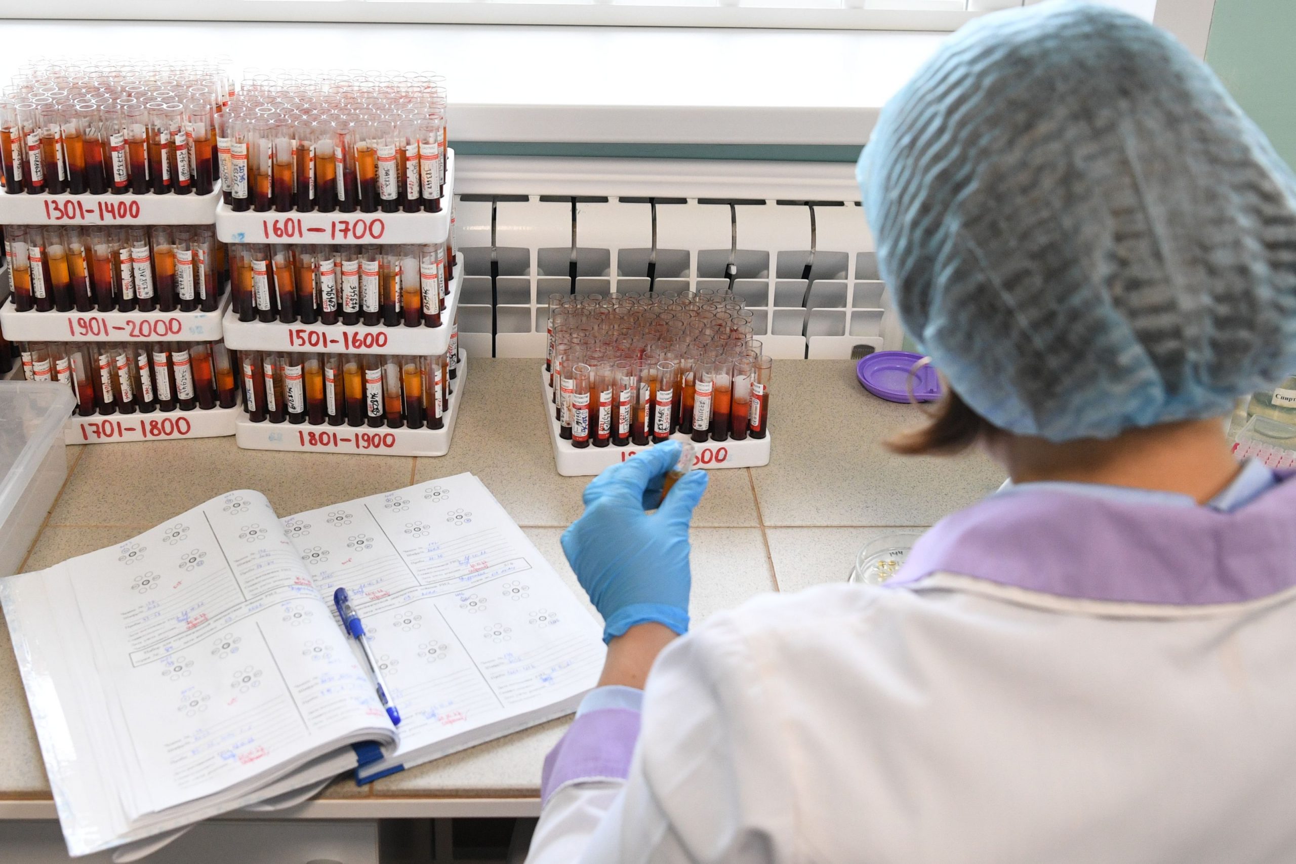 Cerecetătorii au dezvoltat un test de sânge accesibil pentru diagnosticarea bolii Alzheimer