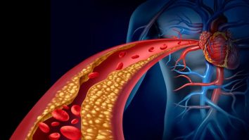 STUDIU. Ce băutură trebuie să evitați pentru a îmbunătăți nivelul colesterolului