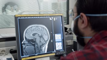 FDA aprobă primul medicament care încetinește progresia Alzheimer. Cât costă tratamentul