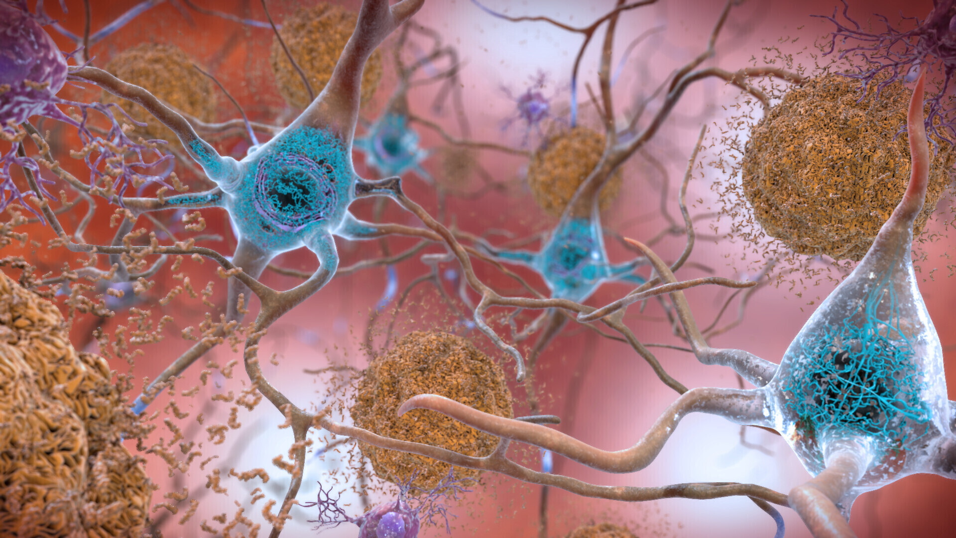 Experții chinezi anunţă primul caz de Alzheimer la un pacient de 19 ani