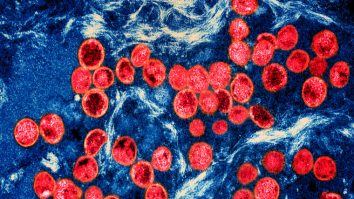 Cercetătorii spun că o a treia persoană a fost vindecată de HIV după un transplant de celule stem