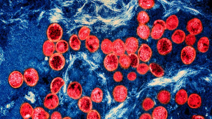 Cercetătorii spun că o a treia persoană a fost vindecată de HIV după un transplant de celule stem