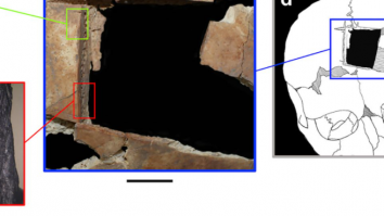 Oamenii de știință descoperă dovezi ale unui tip rar de operație pe creier, de acum 3.500 de ani, efectuată pe doi frați