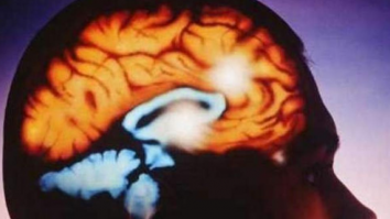 Un bărbat din Florida a murit după ce a fost infectat cu o <em>„</em>amibă mâncătoare de creier” după ce s-a spălat pe nas cu apă de la robinet