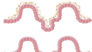 Bacteriile intestinale – cheia tratamentului pentru cancer?