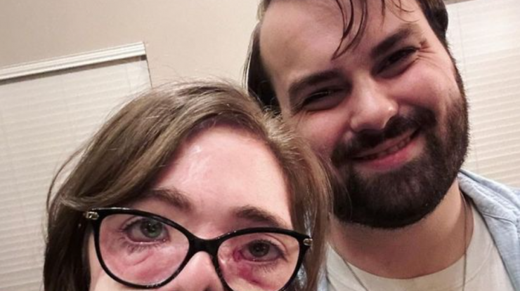 O tânără care a avut fața desfigurată după un atac cu 800 de mușcături de câine împărtășește rezultatele incredibile ale intervențiilor chirurgicale