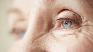 STUDIU. Primele semne de Alzheimer pot apărea în ochii tăi. Cum îți dai seama dacă ai boala