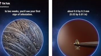 Un videoclip șocant arată ce se întâmplă atunci când păduchii de cap nu sunt tratați timp de o lună