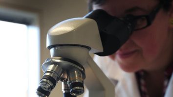 Studiu. O tehnică „revoluționară” ar putea identifica boala Parkinson înainte de apariția simptomelor