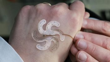 Un dispozitiv în formă de floare ar putea face operațiile pe creier mai puțin invazive și ar putea ajuta pacienții cu epilepsie