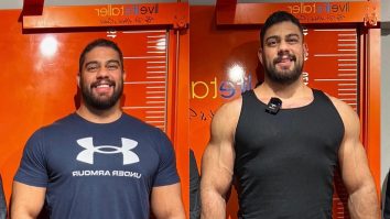 Un bărbat a cheltuit 86.000 de lire sterline pentru a fi mai înalt cu 10 centimetri. Cum s-au desfășurat operațiile