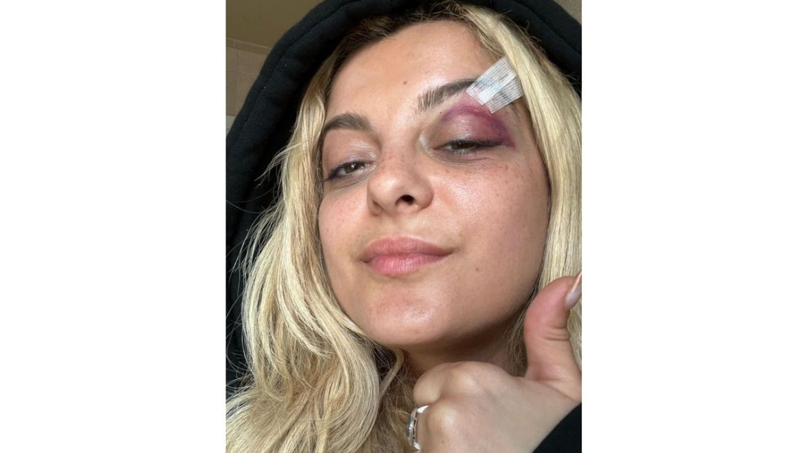 „Fanul” lui Bebe Rexha, acuzat de agresiune după ce a lovit-o pe cântăreață cu telefonul în timpul unui concert