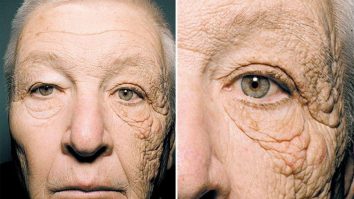 FOTO. O fotografie îți arată efectele a 28 de ani de expunere prelungită la soare. Ce spun experții