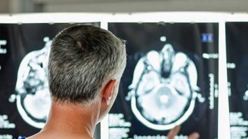 O injecție ar putea să oprească simptomele bolii Alzheimer. Tratamentul se află în prima fază de studiu