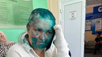 O jurnalistă de investigație și un avocat rus au fost atacați în Cecenia. Femeia a ajuns la spital cu degetele rupte și vopsea verde pe cap