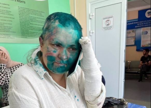 O jurnalistă de investigație și un avocat rus au fost atacați în Cecenia. Femeia a ajuns la spital cu degetele rupte și vopsea verde pe cap