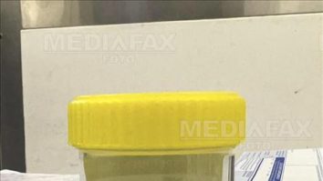 Un vierme viu de 8 centimetri a fost găsit în creierul unei femei din Australia. Cât a trăit cu parazitul