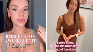 Barbie Botox, cea mai nouă obsesie de pe TikTok, a pornit de la influencerul Isabel Lux. Ce amploare a luat fenomenul în rândul femeilor