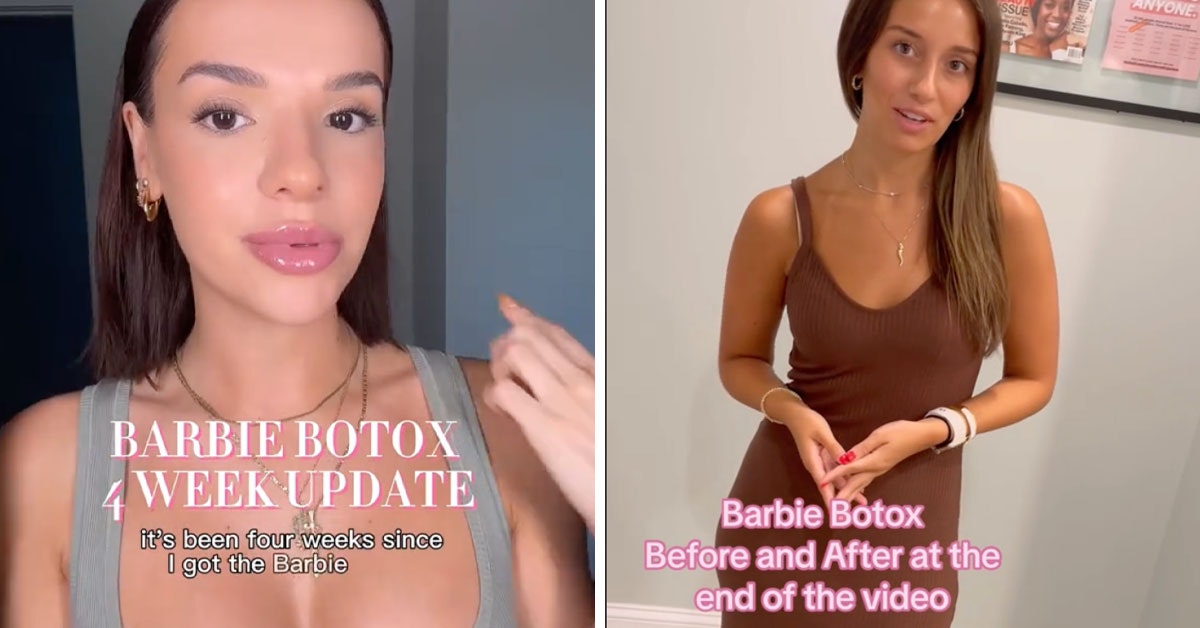 Barbie Botox, cea mai nouă obsesie de pe TikTok, a pornit de la influencerul Isabel Lux. Ce amploare a luat fenomenul în rândul femeilor