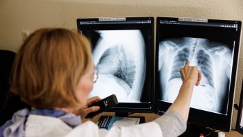 Ai grijă de tine. Numărul cazurilor de cancer crește în rândul tinerilor