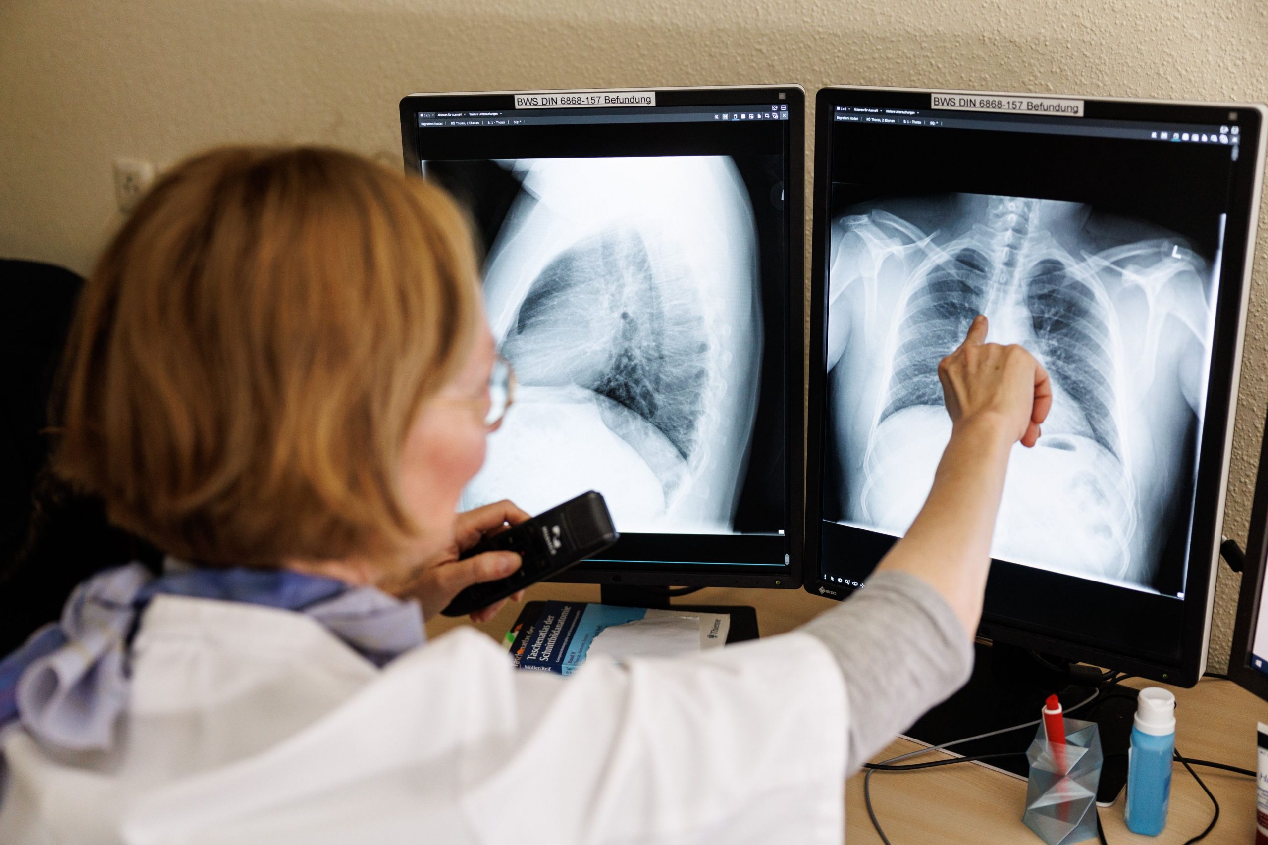 Apare pastila care ar putea ucide cancerul. Cazurile de cancer au crescut cu aproape 80% în ultimii 30 de ani