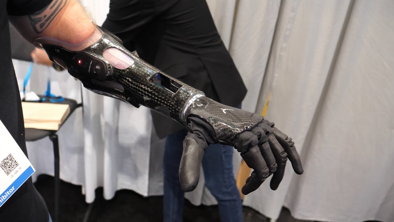 VIDEO. Psyonic lansează singura mână bionică de pe piață. Cât costă o astfel de achiziție