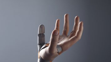 VIDEO. O companie a creat degetul protetic imprimat 3D. Dispozitivul te ajută să îți legi șireturile și cântă la chitară