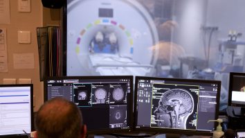 Inteligența artificială, utilizată în operațiile pe creier. Tot mai mulți neurochirurgi o folosesc în domeniu