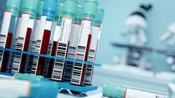 Un test de sânge ar putea identifica urmele de cancer în organism. Cât valorează dispozitivul