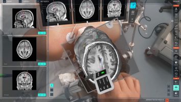 Operezi virtual cu Vision Pro. Poți simula o intervenție chirurgicală prin aplicația SurgicalAR