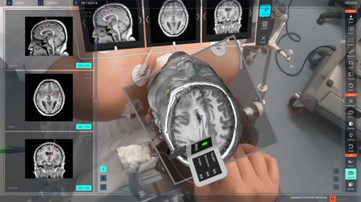 Operezi virtual cu Vision Pro. Poți simula o intervenție chirurgicală prin aplicația SurgicalAR