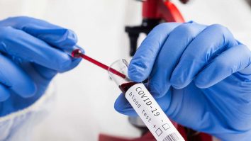 Studiu. Virusul SARS-CoV-2 rămâne în sângele pacienţilor şi la 14 luni după infectare