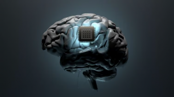 În premieră mondială, un implant cerebral inovator tratează epilepsia și tulburarea obsesiv-compulsivă