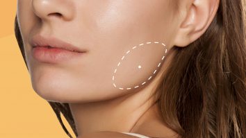 Botoxul nu mai este doar despre frumusețe. Acum, poate fi folosit pentru transpirație și scrâșnitul dinților