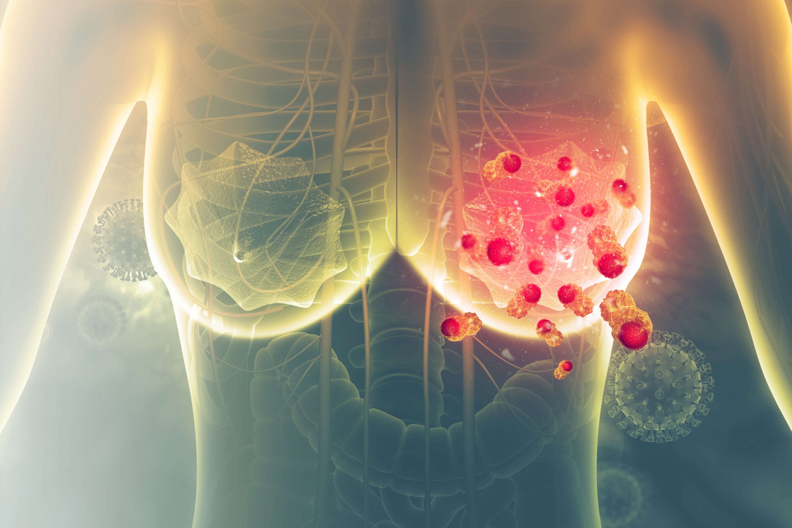 Sutienul îți poate monitoriza cancerul la sân