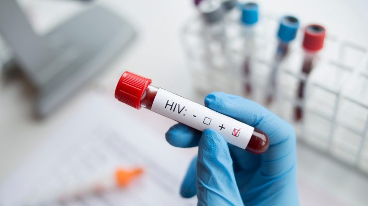 Oamenii de știință au reușit să elimine HIV-ul din celulele infectate, folosind tehnologia Crispr, premiată cu Nobel