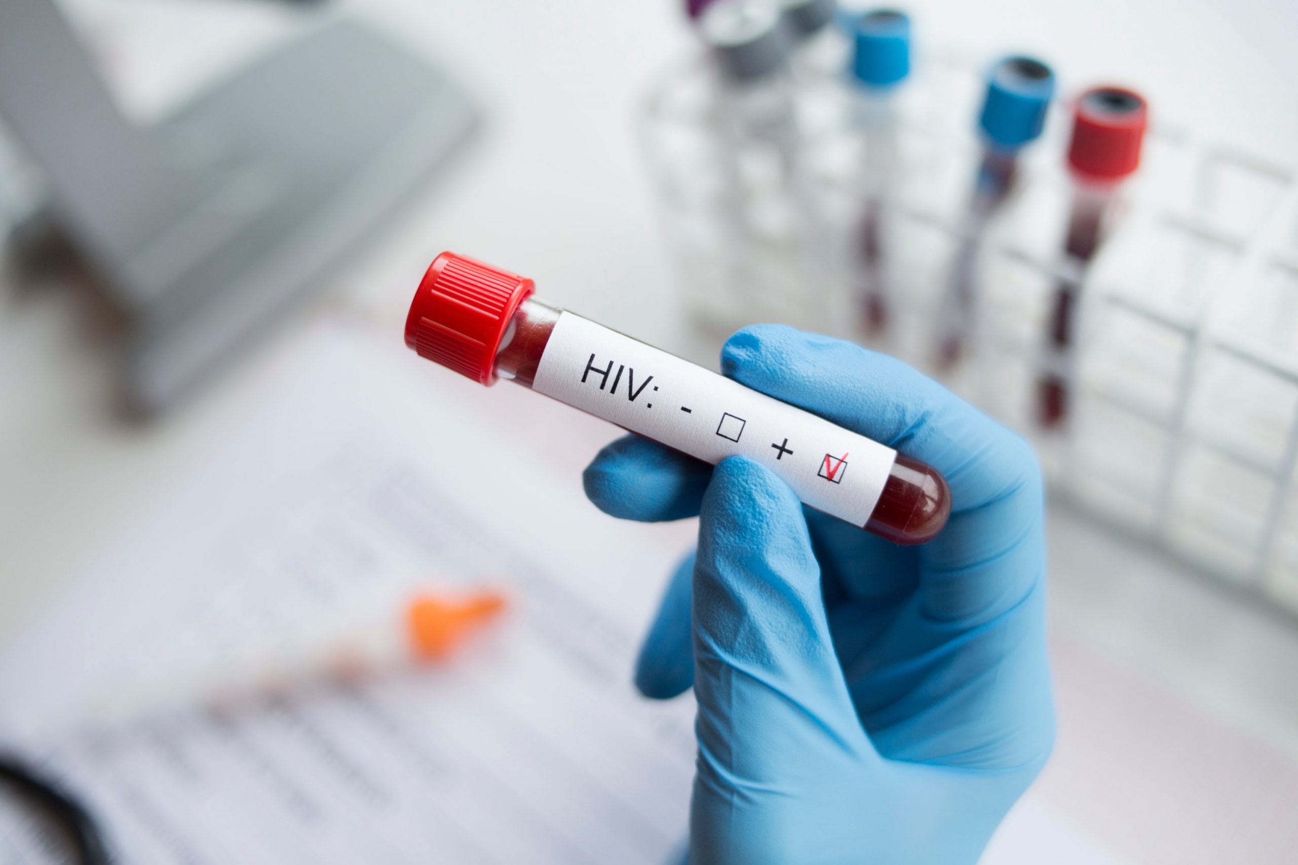 Oamenii de știință au reușit să elimine HIV-ul din celulele infectate, folosind tehnologia Crispr, premiată cu Nobel