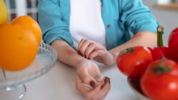 Cum te protejezi de alergii? Alergolog: „Primul lucru pe care trebuie să-l faci este să mergi la medicul specialist”