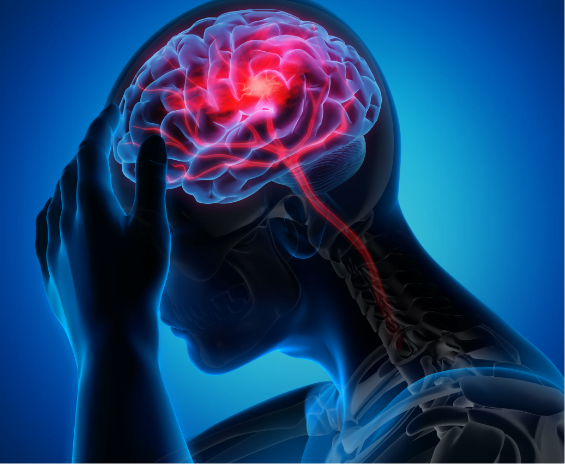 Peste 40% din populația lumii suferă de boli neurologice. Cum stă România la capitolul sănătate