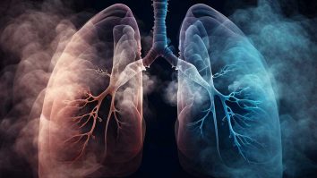 STUDIU. Care ar putea fi cauza cancerului pulmonar? Cercetătorii spun că 15-20% din cazuri apar la persoanele care nu au fumat niciodată