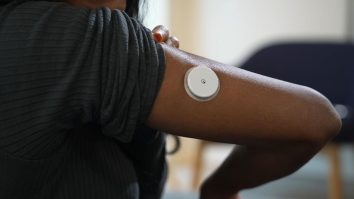 Inițiativă în premieră mondială în Anglia. Copiii și adulții care suferă de diabet de tip 1 vor primi un „pancreas artificial”